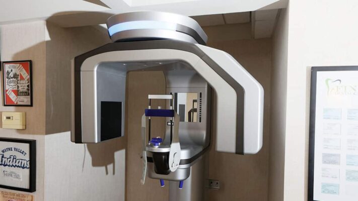 Cone Beam Scanner | CBCT 3D Imaging en Wayne, NJ | Dr. Fine