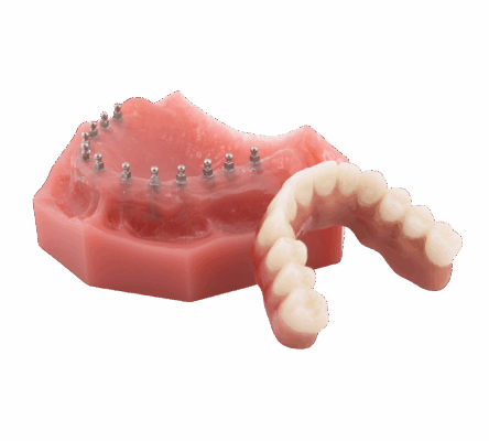 Full Arch Dental Implants in Wayne, NJ | Book a Free Consultation!