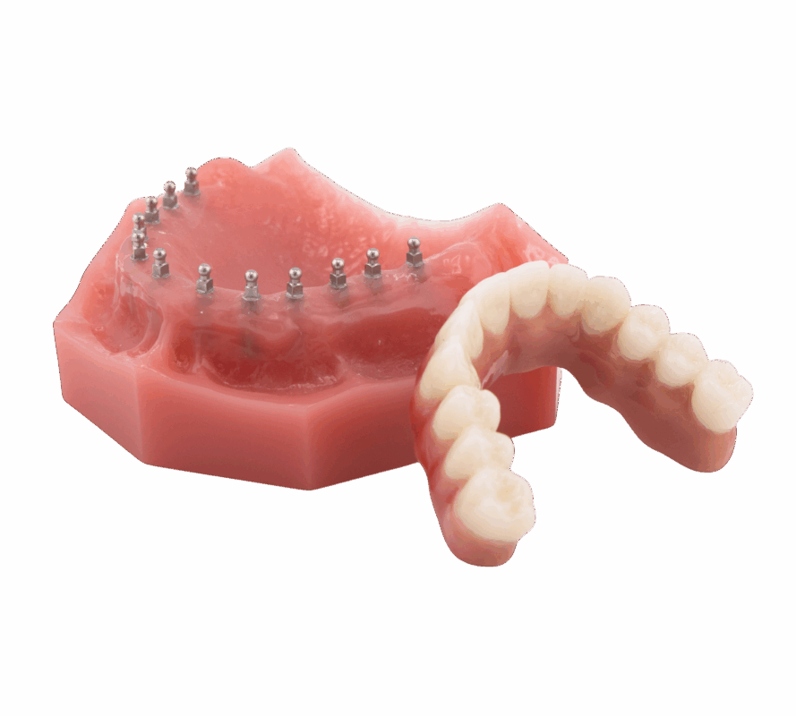 Full Arch Dental Implants in Wayne, NJ | Book a Free Consultation!