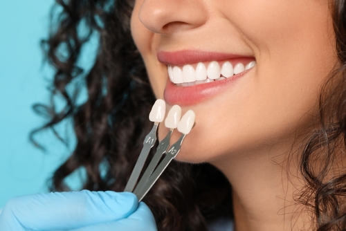 Can You Go Back to Normal Teeth After Veneers | Cosmetic Dentistry in Wayne, NJ