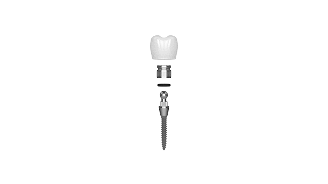 Teeth in a Day in Wayne, NJ | Affordable Mini Dental Implant Treatment
