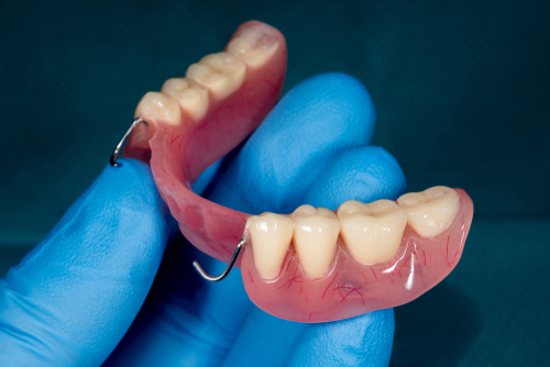 Implant Bridge [Watch Before You Decide] | Partial Denture in Wayne, NJ