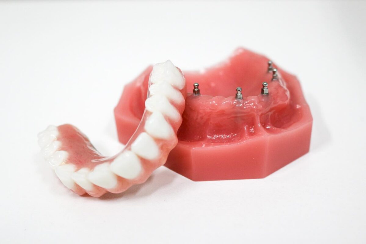 Stabilized Dentures in Wayne, NJ [Video Q&As] Free Consultations