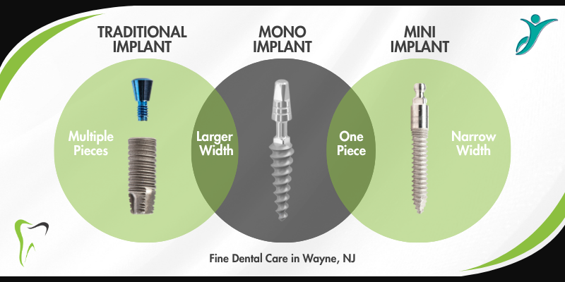 Types of Dental Implants in Wayne, NJ | Free Implant Consultations