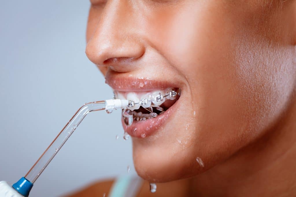 How Often Should You Get a Dental Cleaning